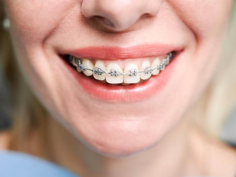 Orthodontic Treatment, Teeth Whitening & Scaling, Cosmetic